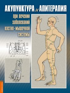 Усакова - Акупунктура и апитерапия при лечении заболеваний костно-мышечной системы